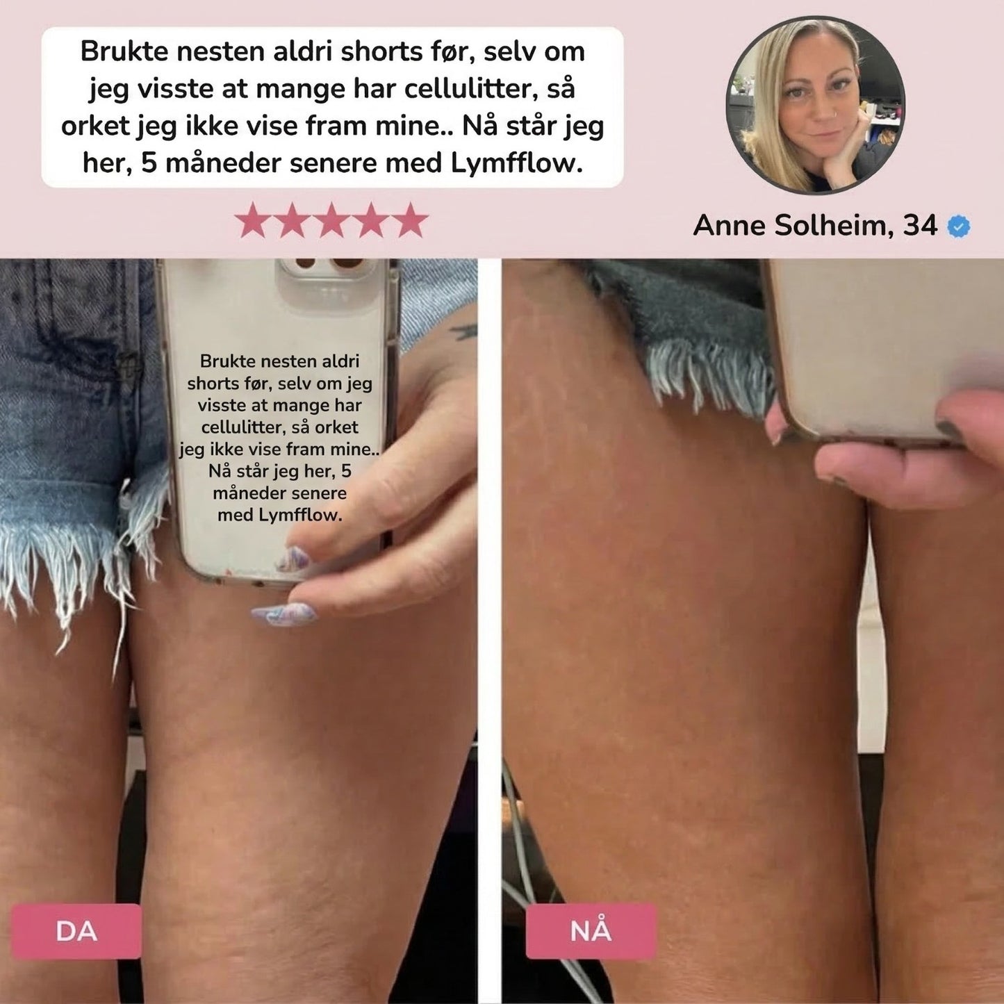 Stegvel® LymphFlow-massasjemaskin