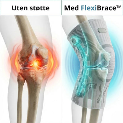 FlexiBrace ™– Smidig bevegelse og stabil støtte uten smerte