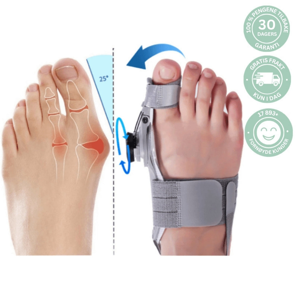 Myk justering og smertelindring for Hallux Valgus