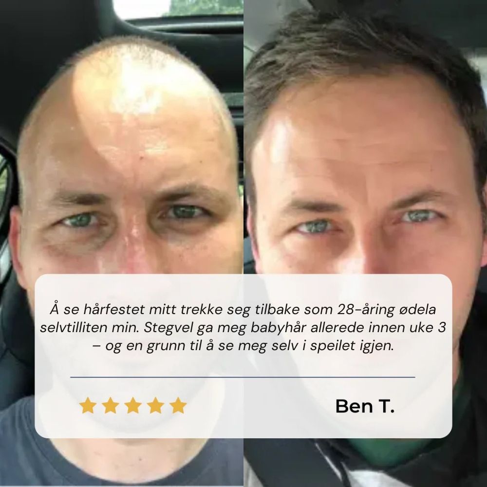 Stegvel Hårfestegjenopprettende Serum