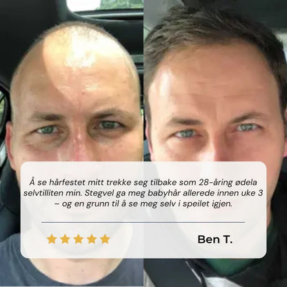 Stegvel Hårfestegjenopprettende Serum