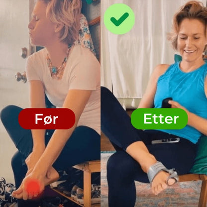 Myk justering og smertelindring for Hallux Valgus