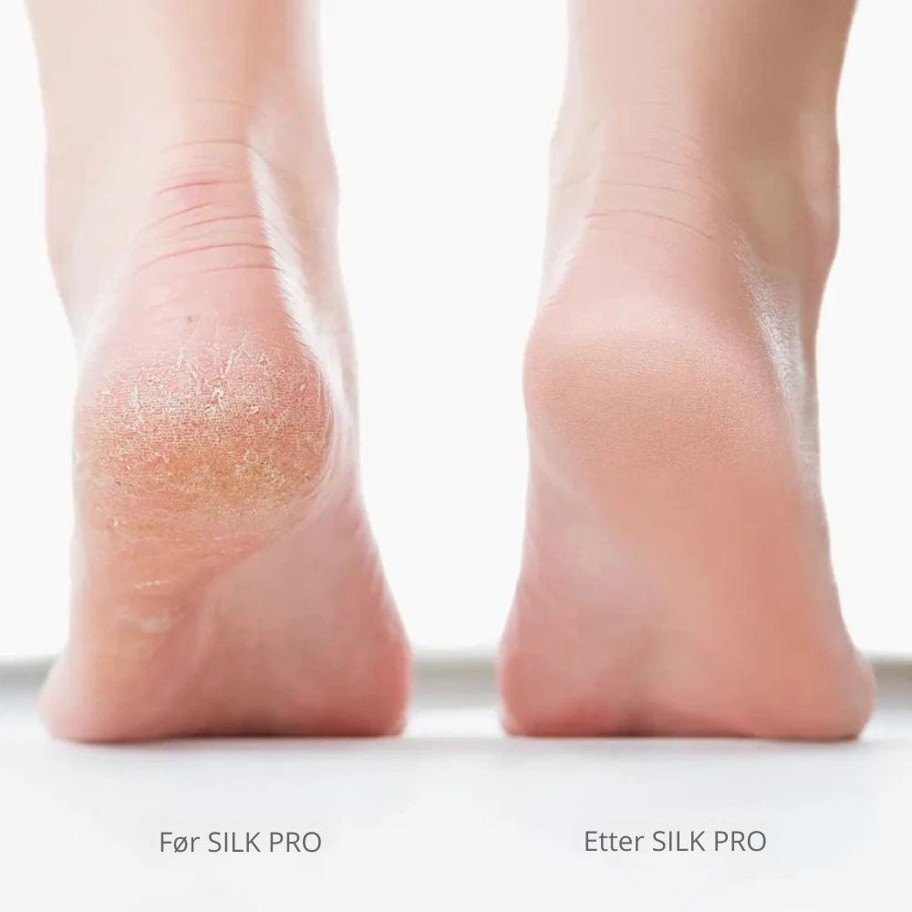 Lissea Silk Pro 2 – Myke føtter uten dyre salongbesøk
