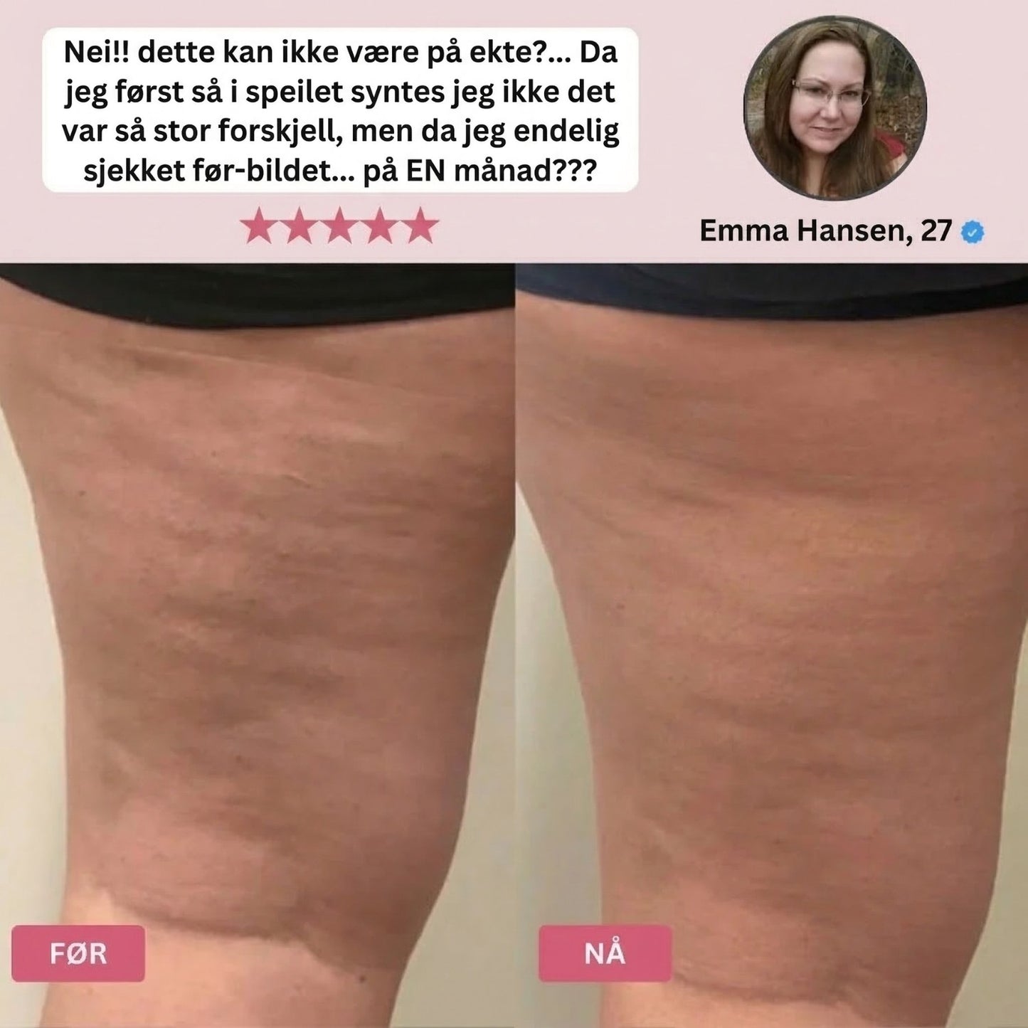 Stegvel® LymphFlow-massasjemaskin
