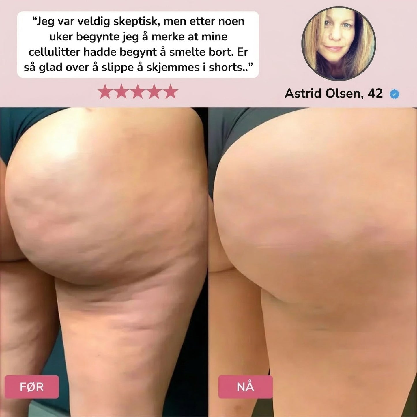 Stegvel® LymphFlow-massasjemaskin